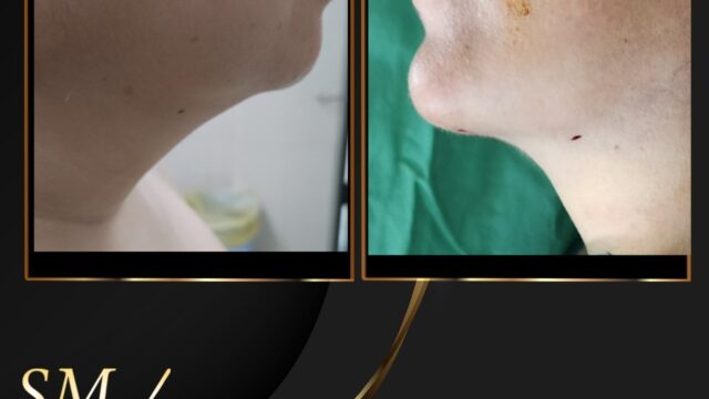 520686896_1074117668204395_6273155371334539394_n