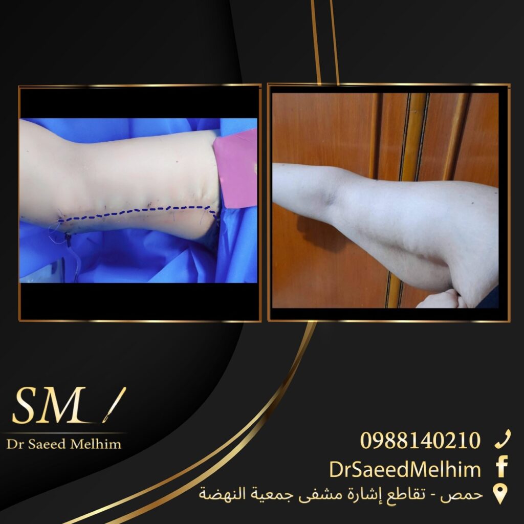 528395173_1086451780304317_1985840956512284221_n