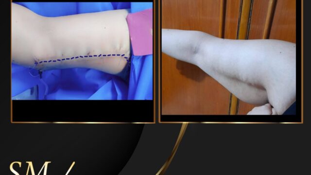 528395173_1086451780304317_1985840956512284221_n