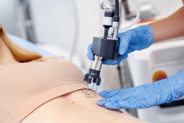 أفضل دكتور نحت الجسم في سوريا