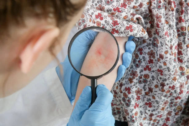 دكتور جلدية باب توما