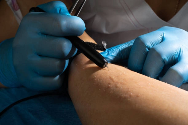 دكاترة جلدية في ركن الدين