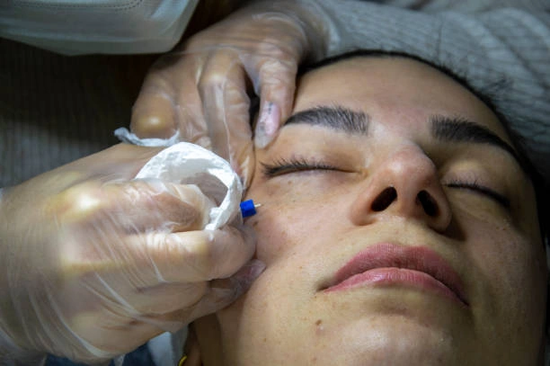 أفضل مركز تجميل في دمشق