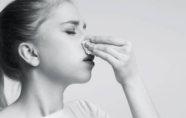 علامات فقر الدم الشديد