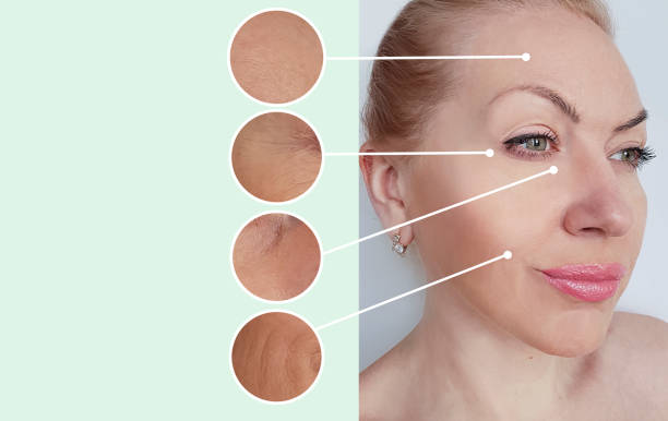 شد البشرة الحديث